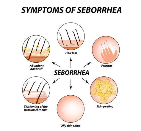 What is the root cause of seborrheic dermatitis?