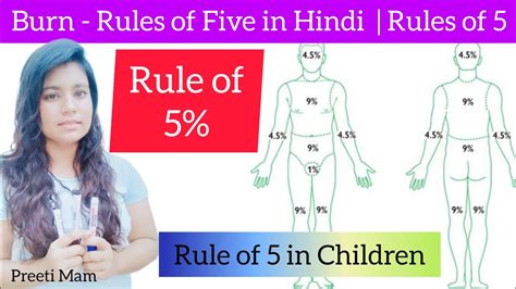 What is the rule of 5 in burns?