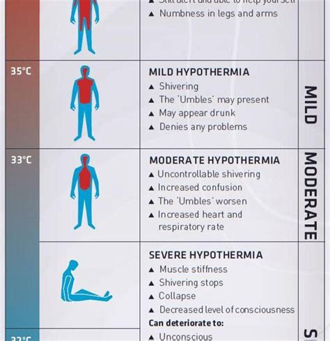 What is the rule of 50 hypothermia?