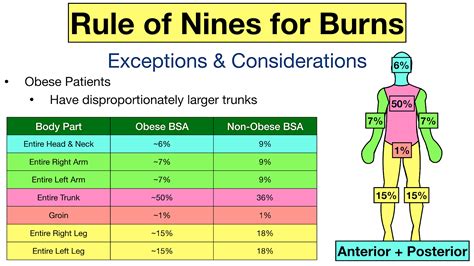 What is the rule of nine in burns PDF?