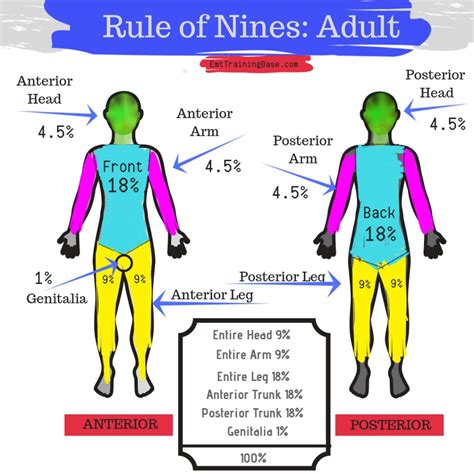 What is the rule of nines Wiki?