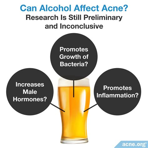 What is the safest alcohol for acne?