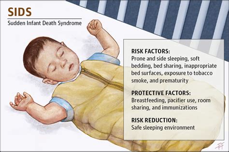 What is the single most risk factor for SIDS?