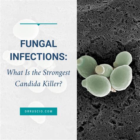 What is the strongest Candida killer?