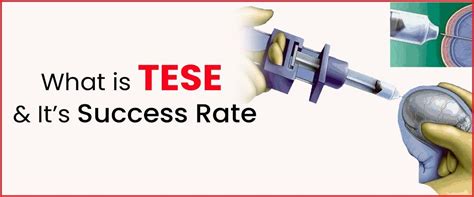 What is the success rate of Tesa vs TESE?