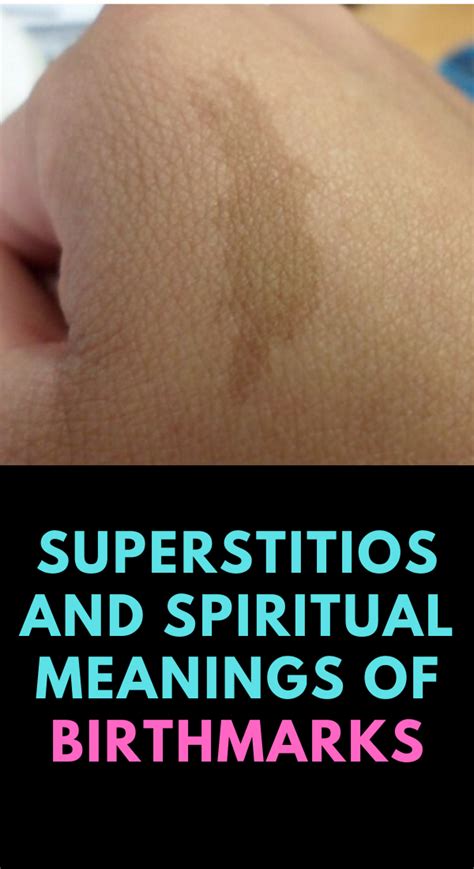 What is the superstition about birthmarks?