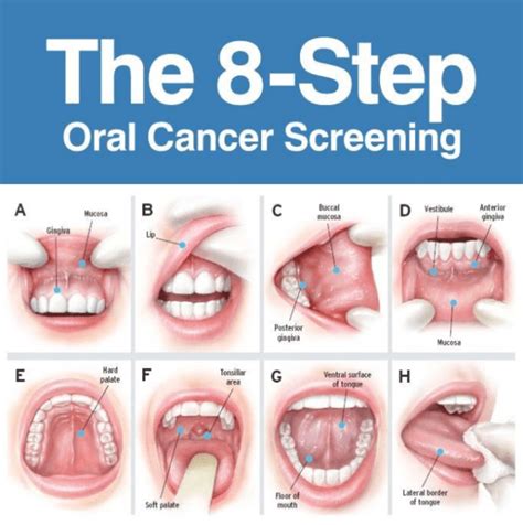 What is the three finger test for oral cancer?