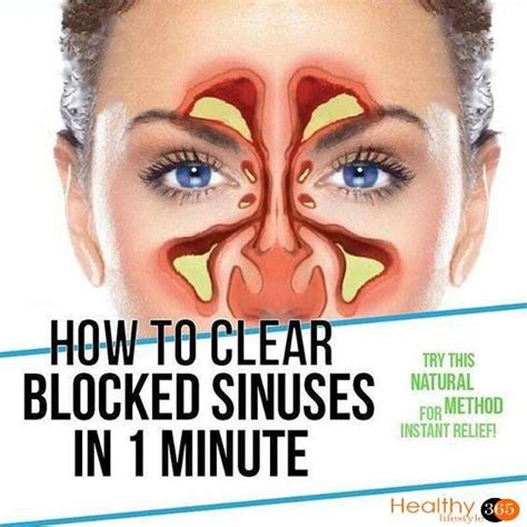 What is the trick for sinusitis?