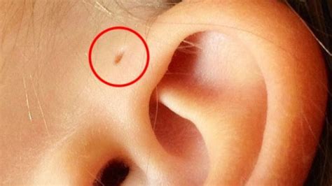 What is the white stuff in my earring hole?