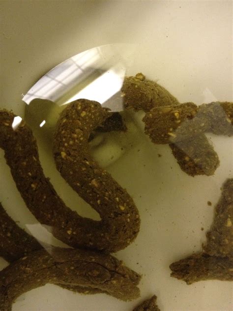 What is the white stuff in my poop?