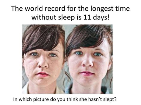 What is the world record of sleeping?