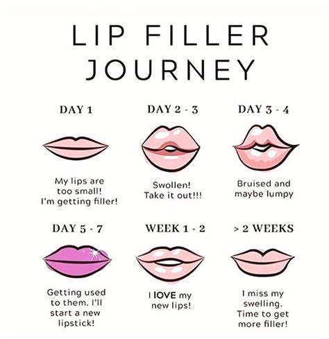 What is the worse day for lip fillers?