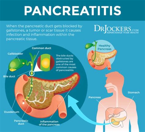 What is toxic to the pancreas?