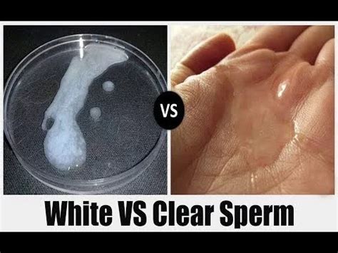 What is watery sperm?