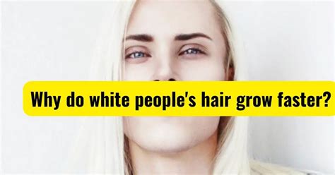 What is white people's hair called?