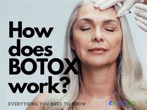 What keeps Botox from working?
