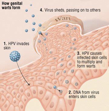 What kills HPV on surfaces?