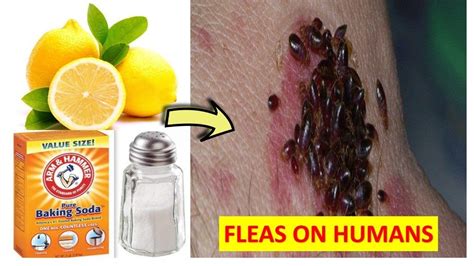 What kills fleas on humans?