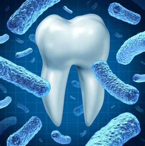 What kills periodontal bacteria?
