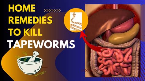 What kills tapeworms in humans naturally?