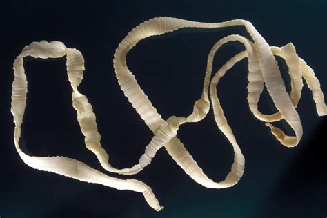 What kills tapeworms in the brain?