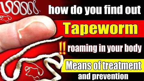 What kills tapeworms instantly?