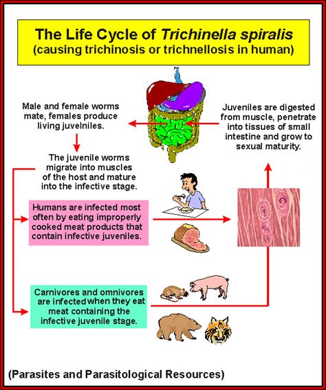 What kills trichinosis?