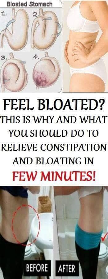 What kind of bloating is not normal?