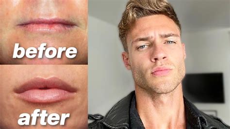 What lips are most attractive for boys?