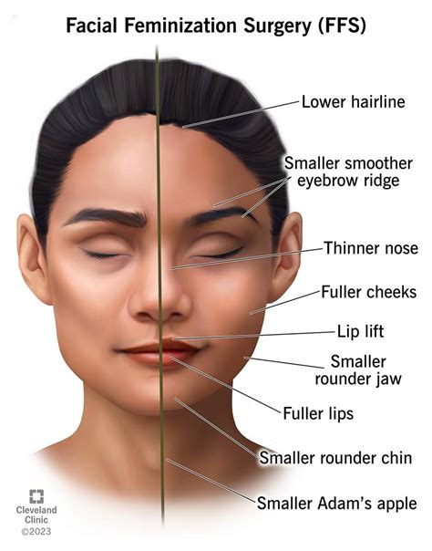 What makes a feminine chin?