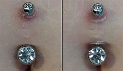 What makes a piercing bump go down?