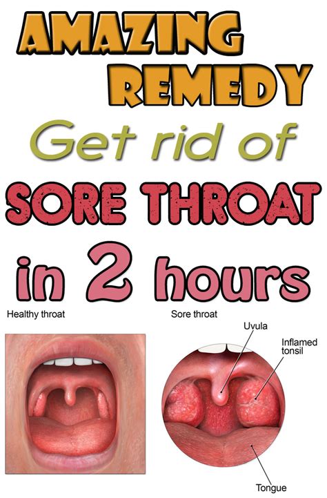 What makes a sore throat worse?