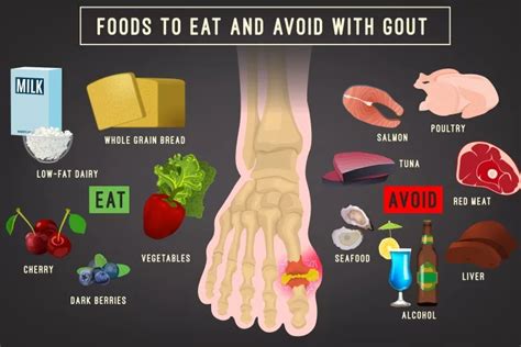 What makes gout worse?