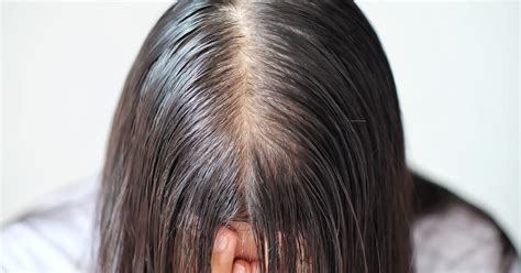 What makes oily hair worse?