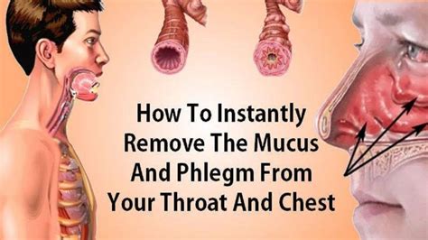 What melts mucus in chest?