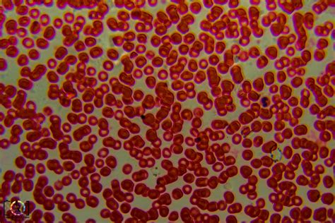 What microscope can see blood cells?