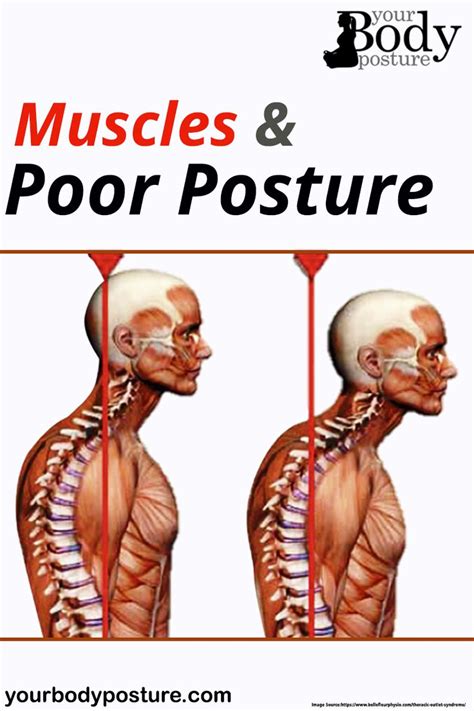 What muscles are weak bad posture?