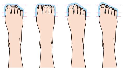 What nationality has a longer second toe?