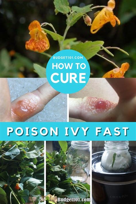 What naturally dries up poison ivy?