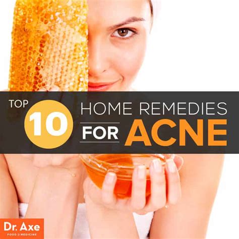 What naturally kills acne?