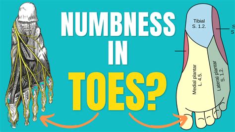 What nerve causes numbness in left foot?