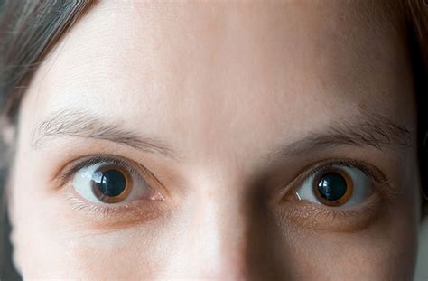 What not to do after eye dilation?