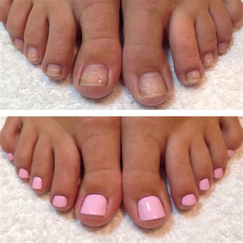 What not to do before a pedicure?