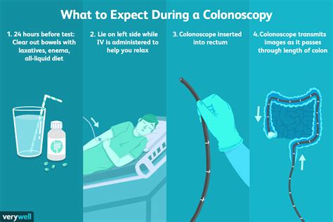 What not to do during colonoscopy prep?