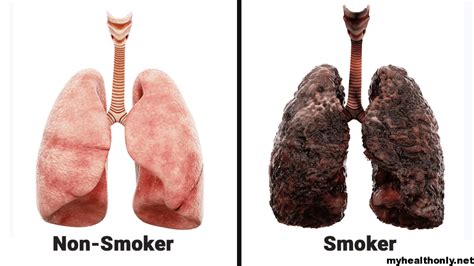 What not to do to your lungs?