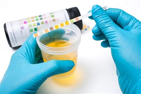 What not to have before a urine test?