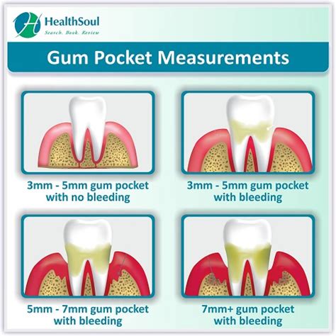 What number should gum pockets be?