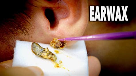 What oil is OK for ears?