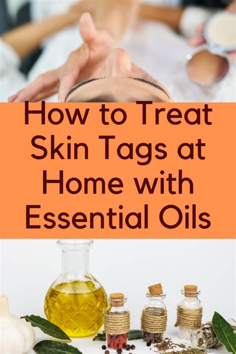 What oil is best for skin tags?