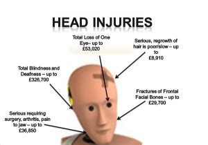 What part of the head is most vulnerable?